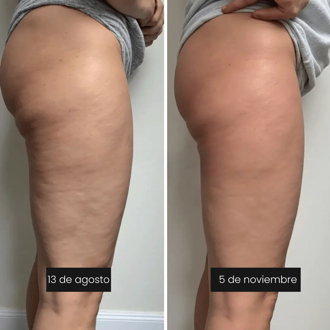 CelluFit™ – Leggings 3D Anticelulíticos y Moldeadores