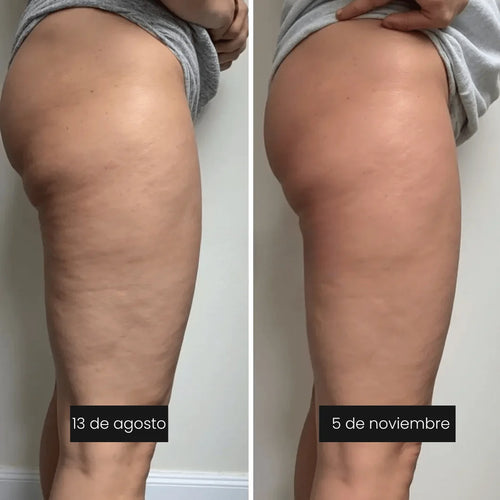 CelluFit™ – Leggings 3D Anticelulíticos y Moldeadores
